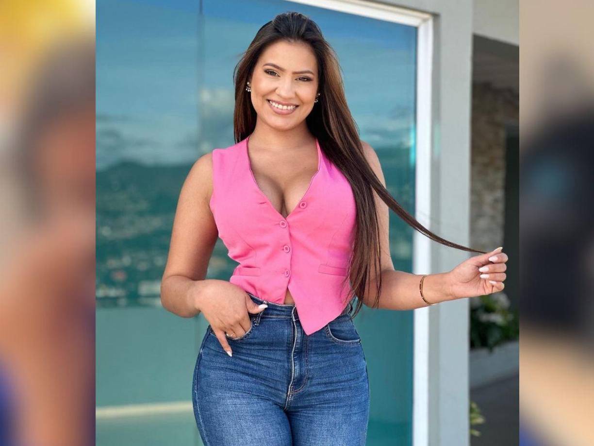 La popular Alejandra aseguró que desconoce las razones por las que su ojo está así, sin embargo visitará a un médico. 