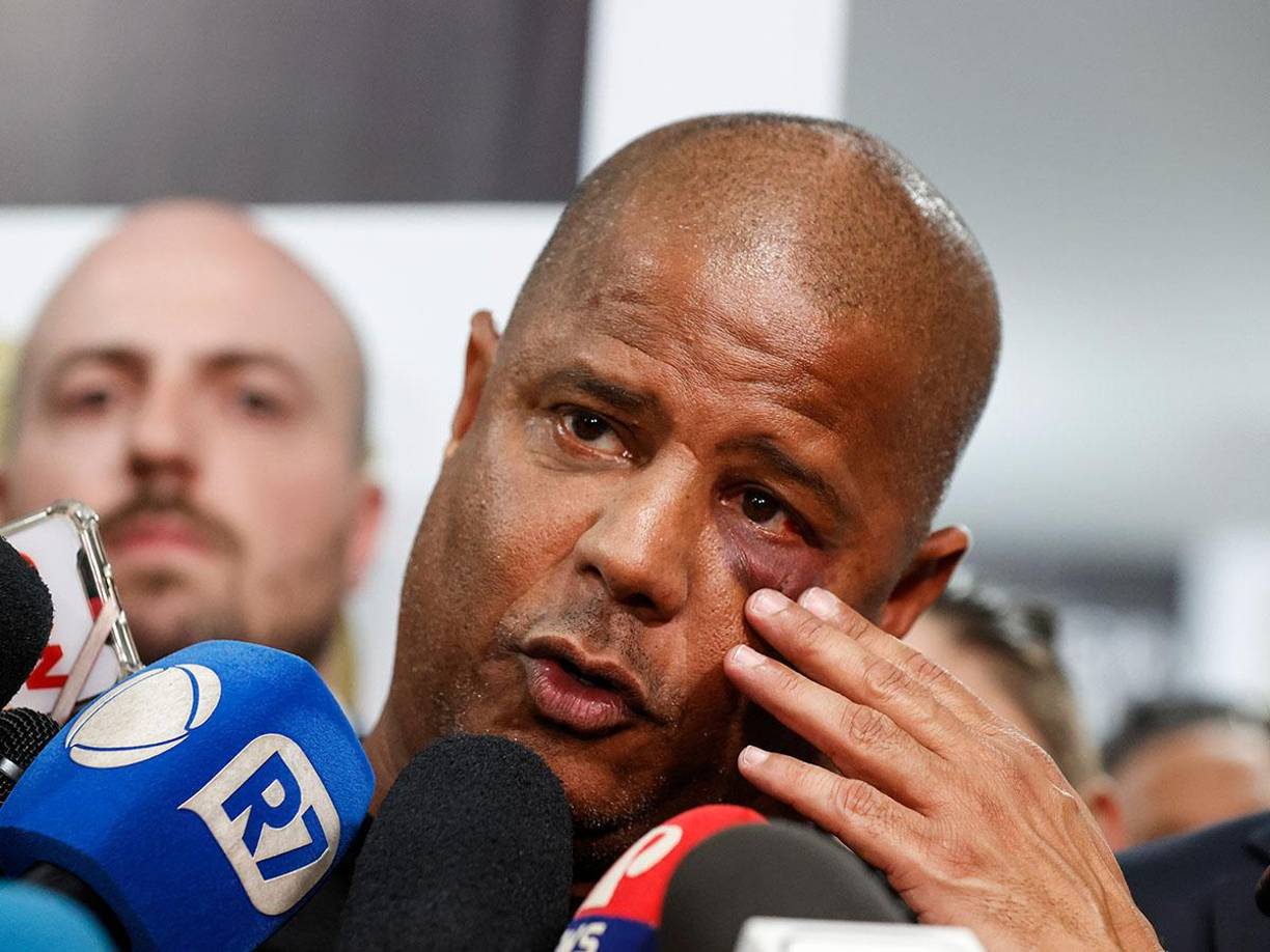 “Me dieron un culetazo en la cabeza y cuando entré al carro me colocaron una capucha y ya no vi nada”, afirmó.