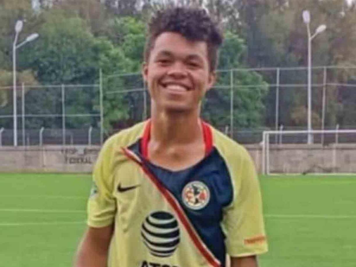 El jugador colombiano forma parte de la tercera división y fue golpeado salvajemente durante un partido que estaba disputando en Texcoco, estado de México. 