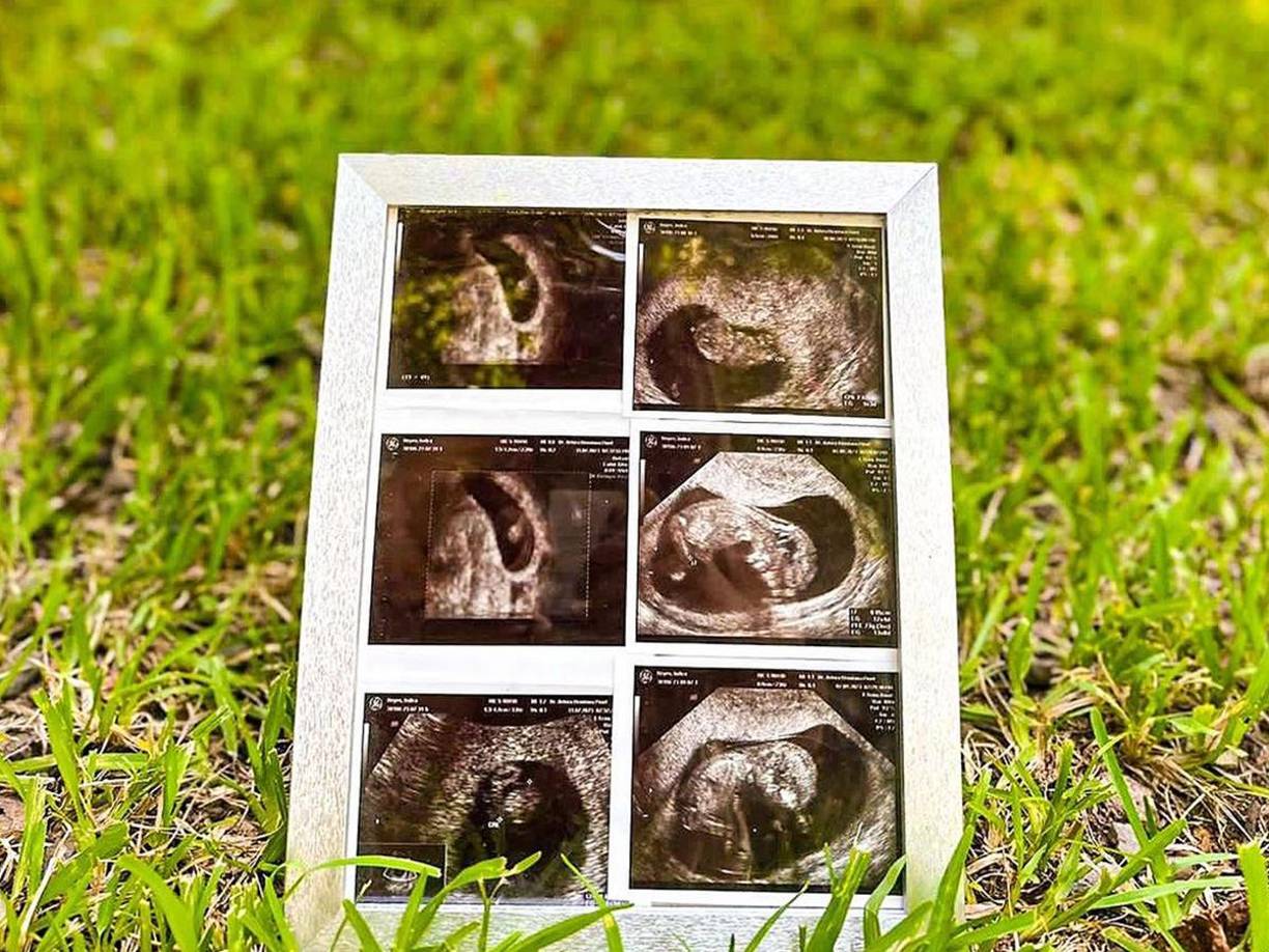 Mediante sus redes sociales, la joven anunció que está embarazada e inmediatamente generó diversos comentarios. 