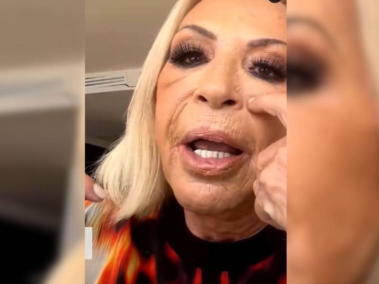 Tras su salida de reality de cocina, la presentadora de ‘Laura en América’ decidió hablar con sus seguidores a través de las redes sociales; sin embargo, lo que más llamó la atención fue su aspecto físico.