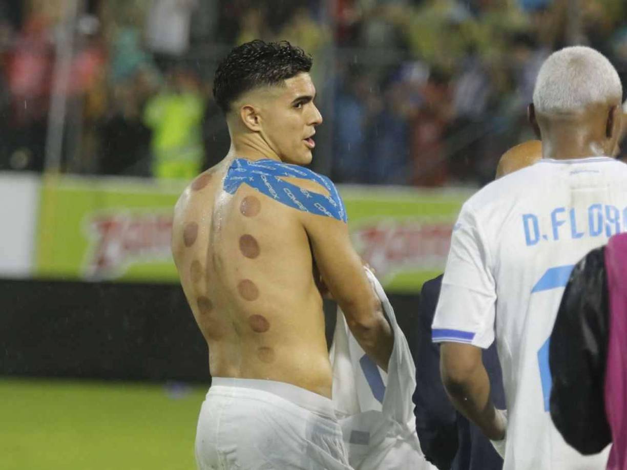 ¿Qué significan esos moretones en la espalda de Luis Palma?, esa es la pregunta que muchos se han hecho en las redes sociales. 