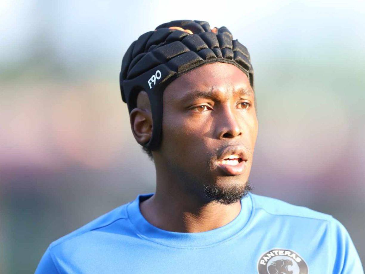 Albert Elis sigue superando la fractura de cráneo que lo apartó de las canchas del fútbol en el mes de febrero del presente año 2024. 