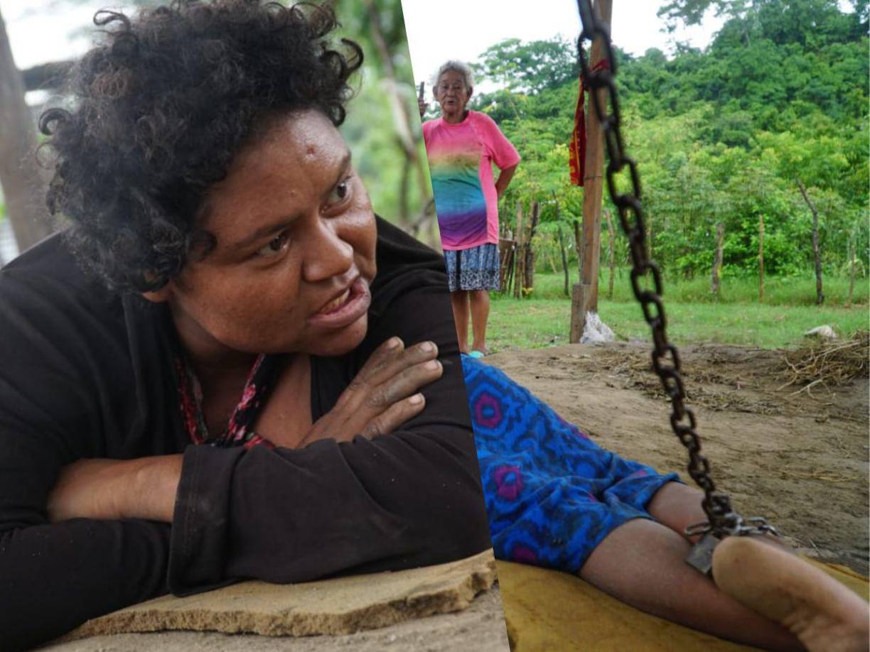 Hasta ayer, el clamor de doña María Elena Guillén por ayuda para su hija Félix Petronila no había tenido ningún eco entre autoridades y demás sectores de la sociedad sampedrana.