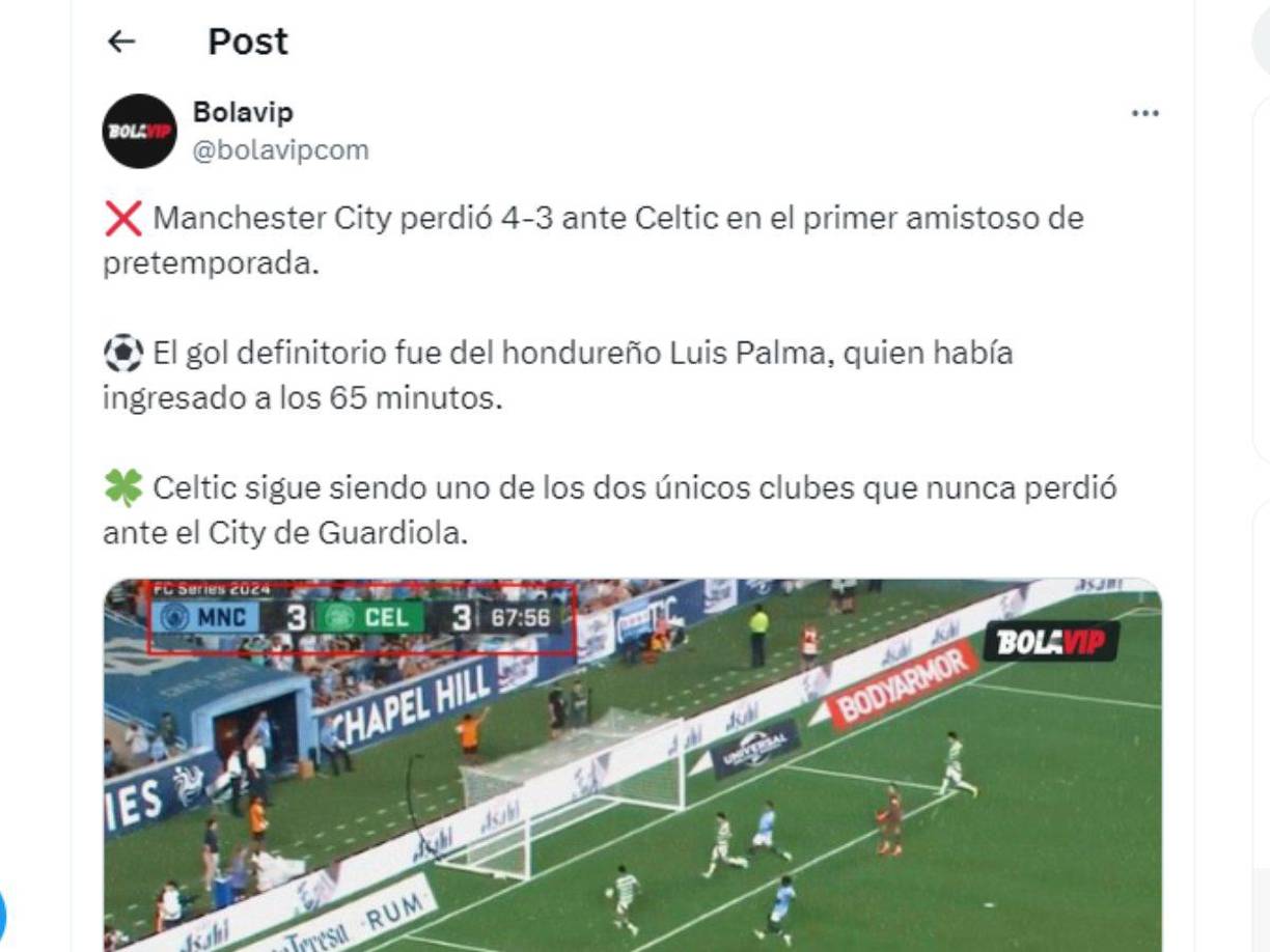 Prensa internacional se pronunció sobre el triunfo del Celtic ante Manchester City en donde Luis Palma fue el MVP al marcar el gol definitivo del juego.