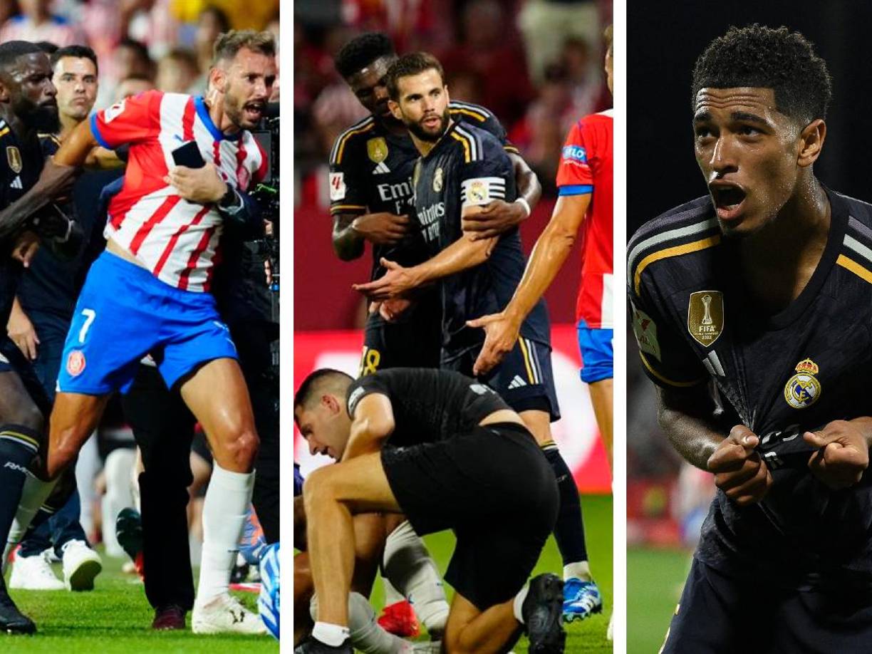 Las imágenes que dejó el triunfo del Real Madrid 3-0 al Girona por la séptima jornada de la Liga Española. 