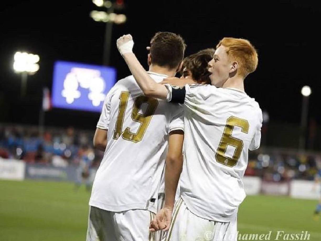 El conjunto de Álvaro Arbeloa se las prometía muy felices con el 0-6 a los escoceses, pero en el minuto 77 llegó una fatídica lesión.