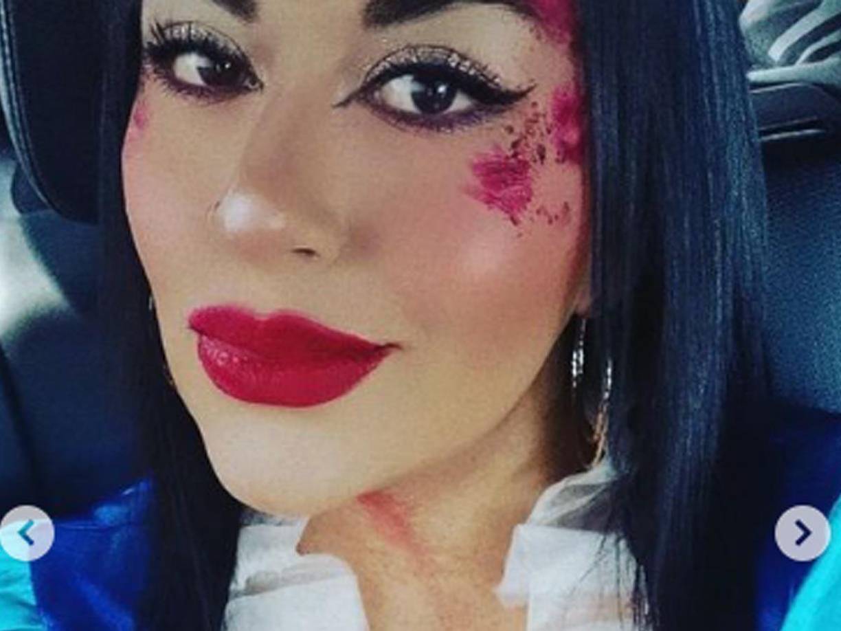 Falleció tras someterse a una cirugía estética en una clínica ubicada en la Alcaldía Cuauhtémoc.