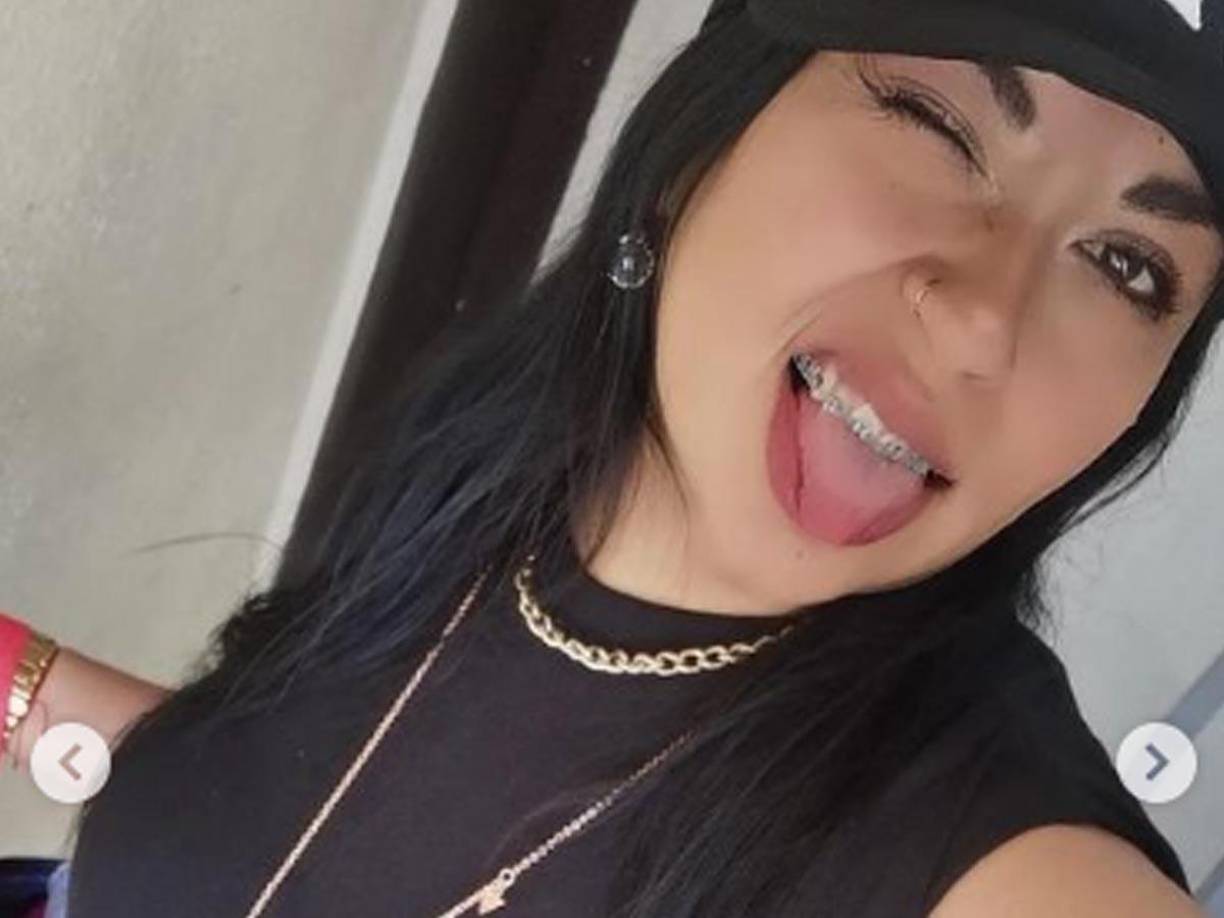 Días antes de someterse a una liposucción aparecía en sus<b> redes sociales </b>sonriente y fumando un cigarro.