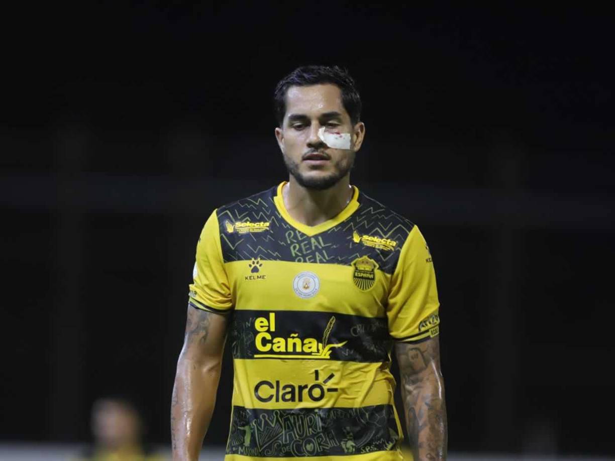 Jim Morrison sufrió un corte en la mejilla izquierda durante el partido y terminó jugando con un pequeño vendaje.