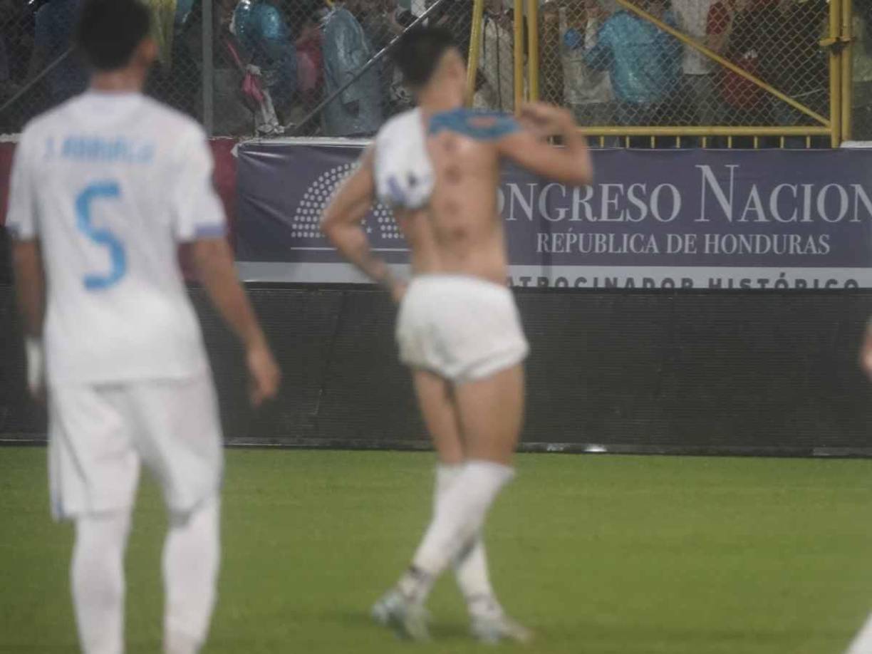 Se trata de una terapia que se hace con ventosas, que se colocan en la espalda con el objetivo de conseguir que hagan vacío y así favorecer la circulación sanguínea y linfática, entre muchos otros beneficios. 