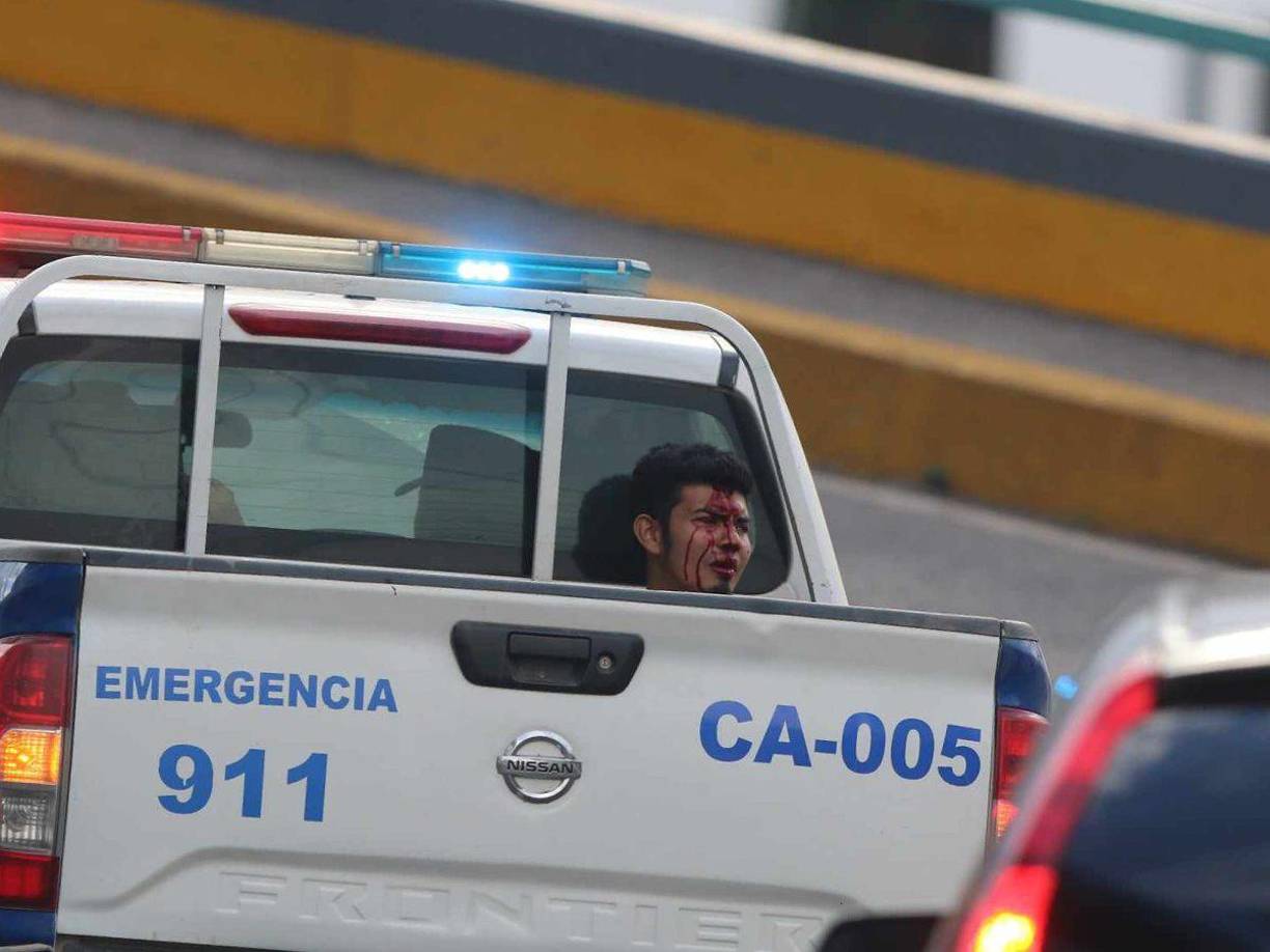 Aficionado fue detenido y estaba herido luego de los disturbios entre barras de los clubes capitalinos. 