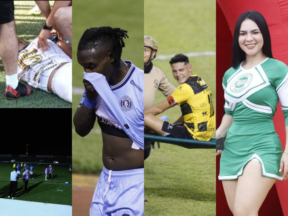 Los primeros tres partidos de la jornada 2 del torneo Apertura 2024 tuvo de todo un poco. Aquí te dejamos las imágenes de lo que no se vio en los tres partidos. 