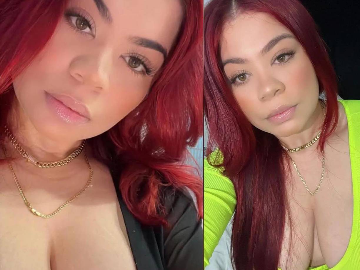 El 16 de diciembre, Pamela acudió al centro médico para realizarse una cirugía de reducción de senos, según informaron sus familiares. 