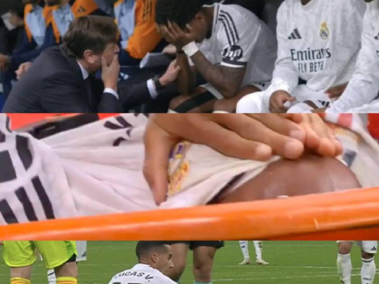 Pero poco después, el Real Madrid sufrió su tercera baja, todo en el primer tiempo. 