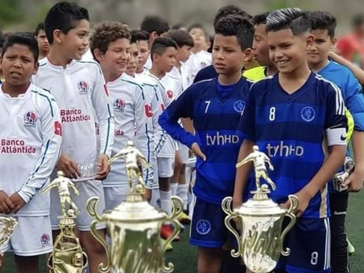 Sus primeros pasos los dio con el Ciclón Azul de Tegucigalpa, una academia privada en donde sus golazos ya retumbaban contra diferentes clubes de las categorías inferiores de la capital del país.