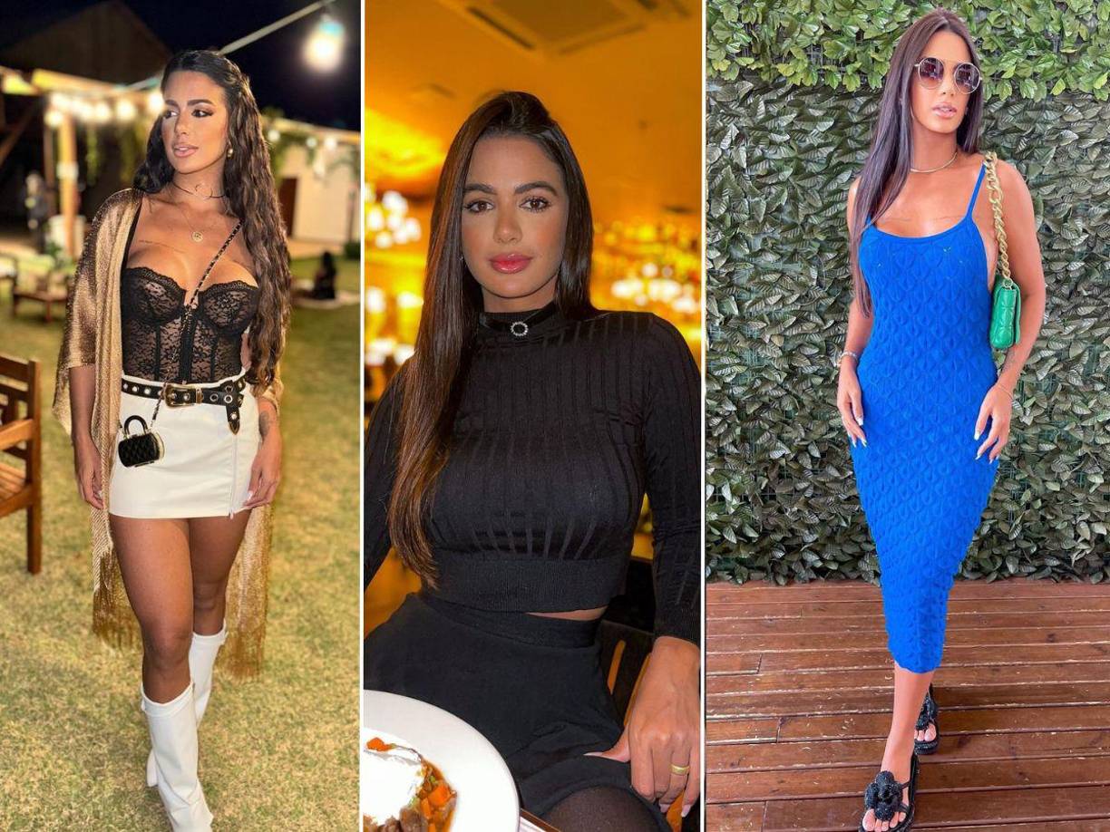 Aline Ferreira, reconocida influencer brasileña de 33 años, falleció el pasado martes debido a complicaciones derivadas de un procedimiento quirúrgico para aumentar el tamaño de sus glúteos.