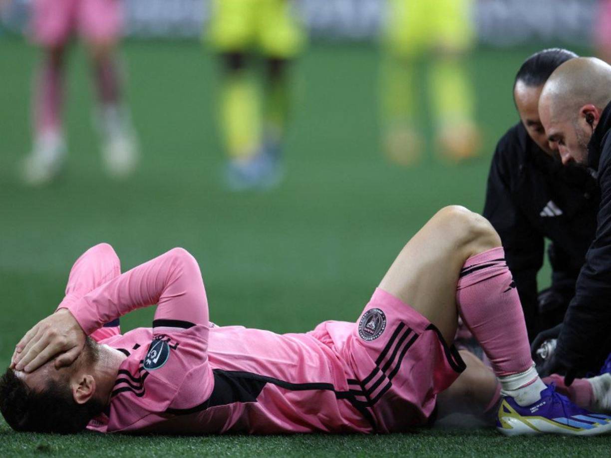 Uno de los tres motivos por los que Messi no estuvo ante CF Montréal fue por el terrible golpe que sufrió ante Nashville en el duelo de la Copa de Campeones de Concacaf.