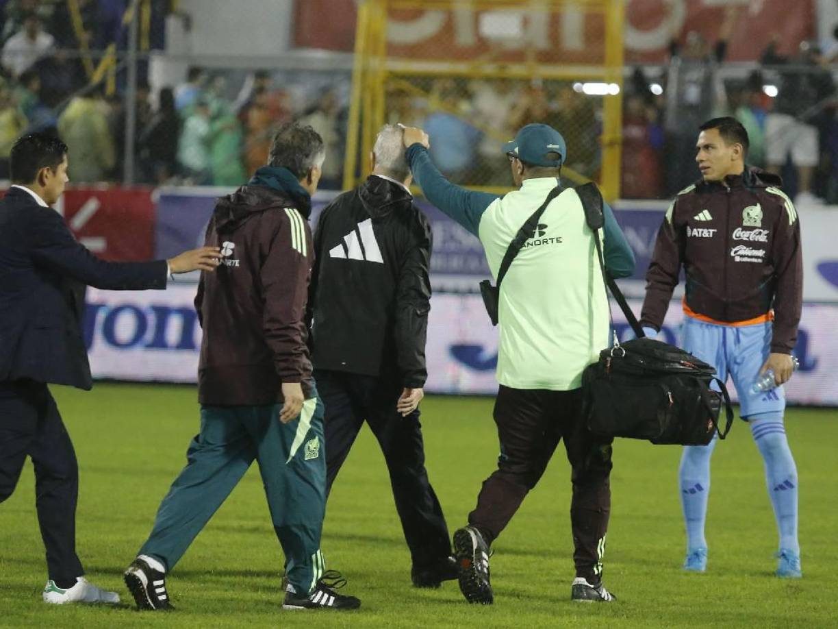 Aguirre muestra cómo quedó tras el impacto de la botella en su cabeza. El DT mexicano vivió un completo infierno en suelo hondureño.