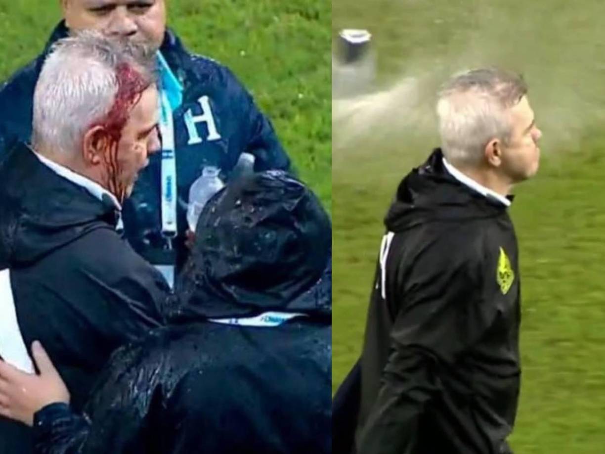 Las imágenes rápidamente se viralizaron y causaron indignación y molestia entre la prensa hondureña y mexicana.