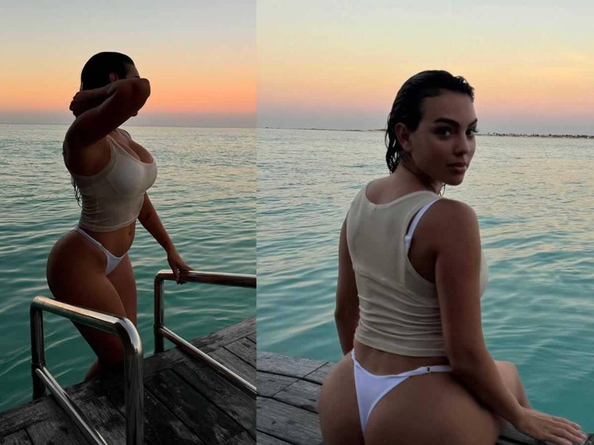 Georgina también ha rediseñado sus cejas y ha sometido a tratamientos para corregir ojeras, rellenar pómulos y mejillas, y marcar el ángulo mandibular y el óvalo facial. Su piel radiante se atribuye a procedimientos como radiofrecuencia, ultrasonidos, peelings, mascarillas y vitaminas.