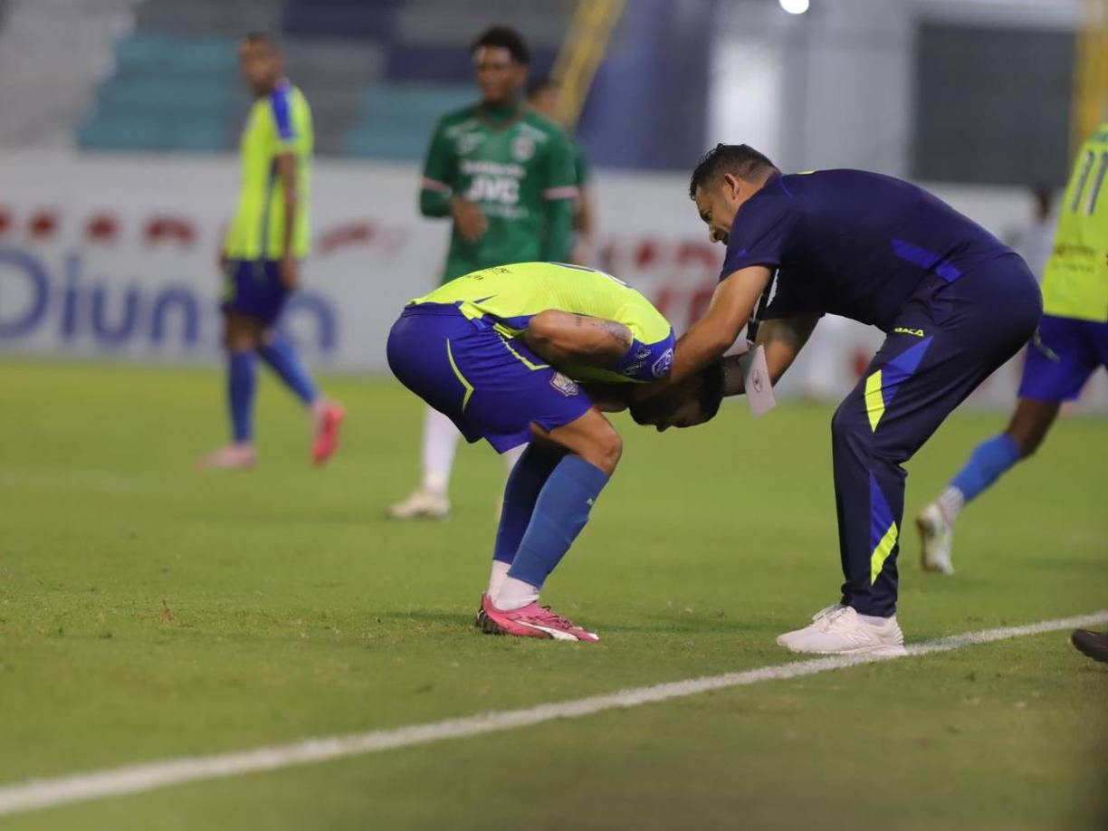 El jugador del Olancho FC sufrió zafadura en uno de los dedos de la mano izquierda.