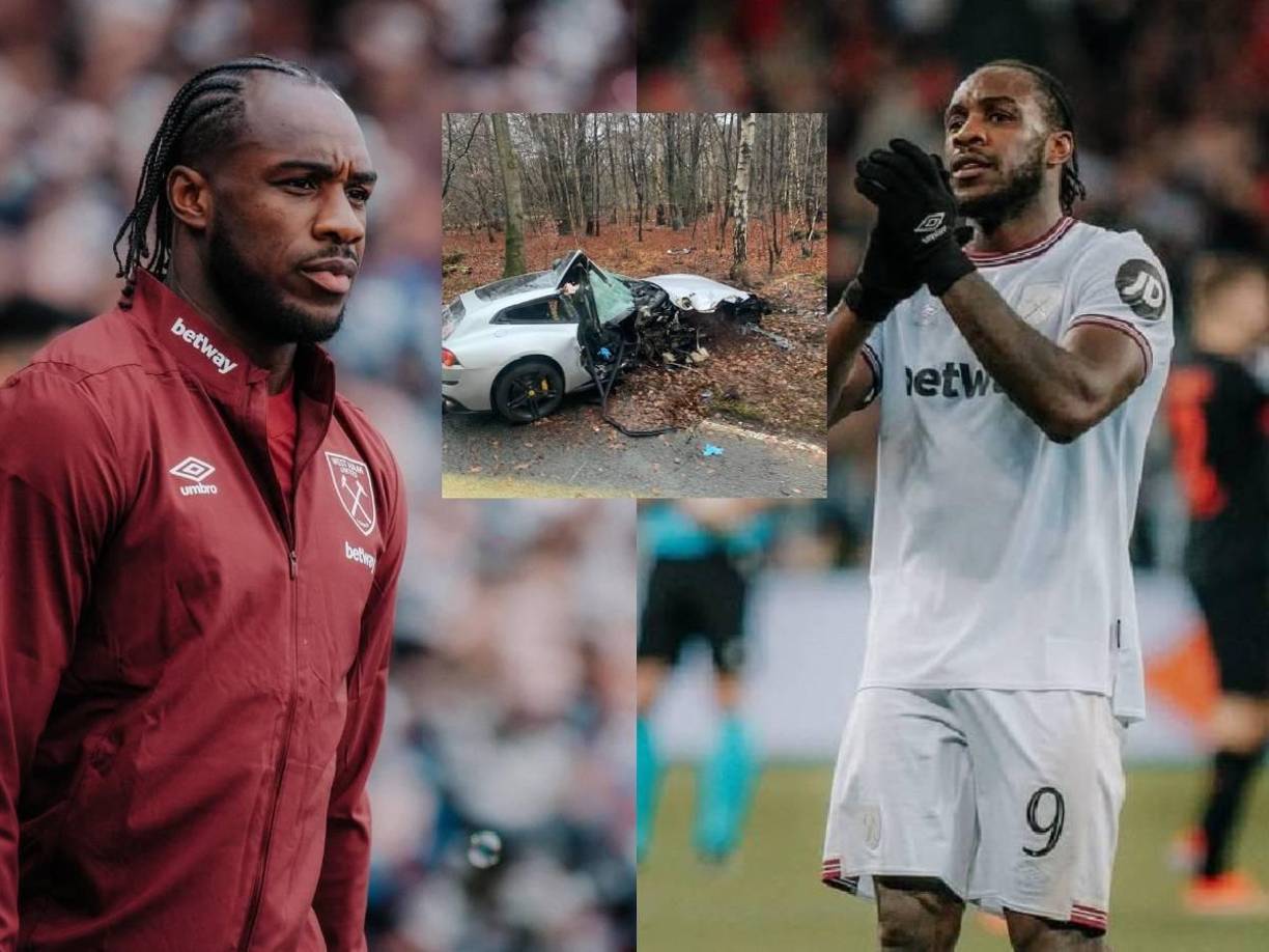 Preocupación. Este sábado se ha informado que un futbolista de la Concacaf ha sufrido un terrible accidente en Inglaterra.