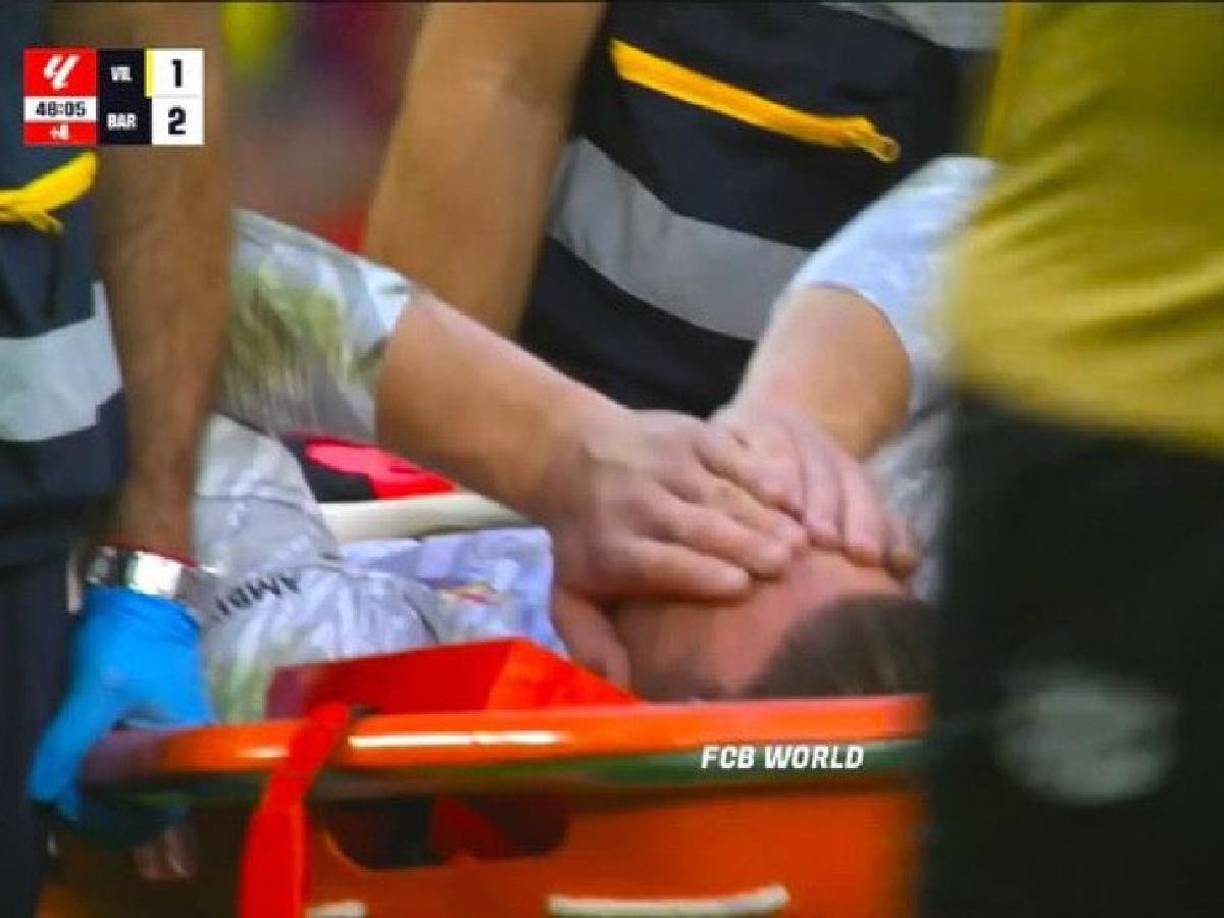 El portero fue aplaudido mientras salía del terreno de juego, desconsolado y rompiendo en llanto por su lesión.