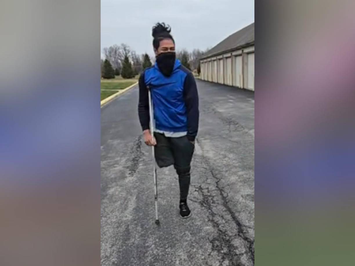 Hace nueve años, su vida cambió tras un accidente en el que perdió una pierna. Sin embargo, este desafío no lo detuvo en su camino hacia el éxito.