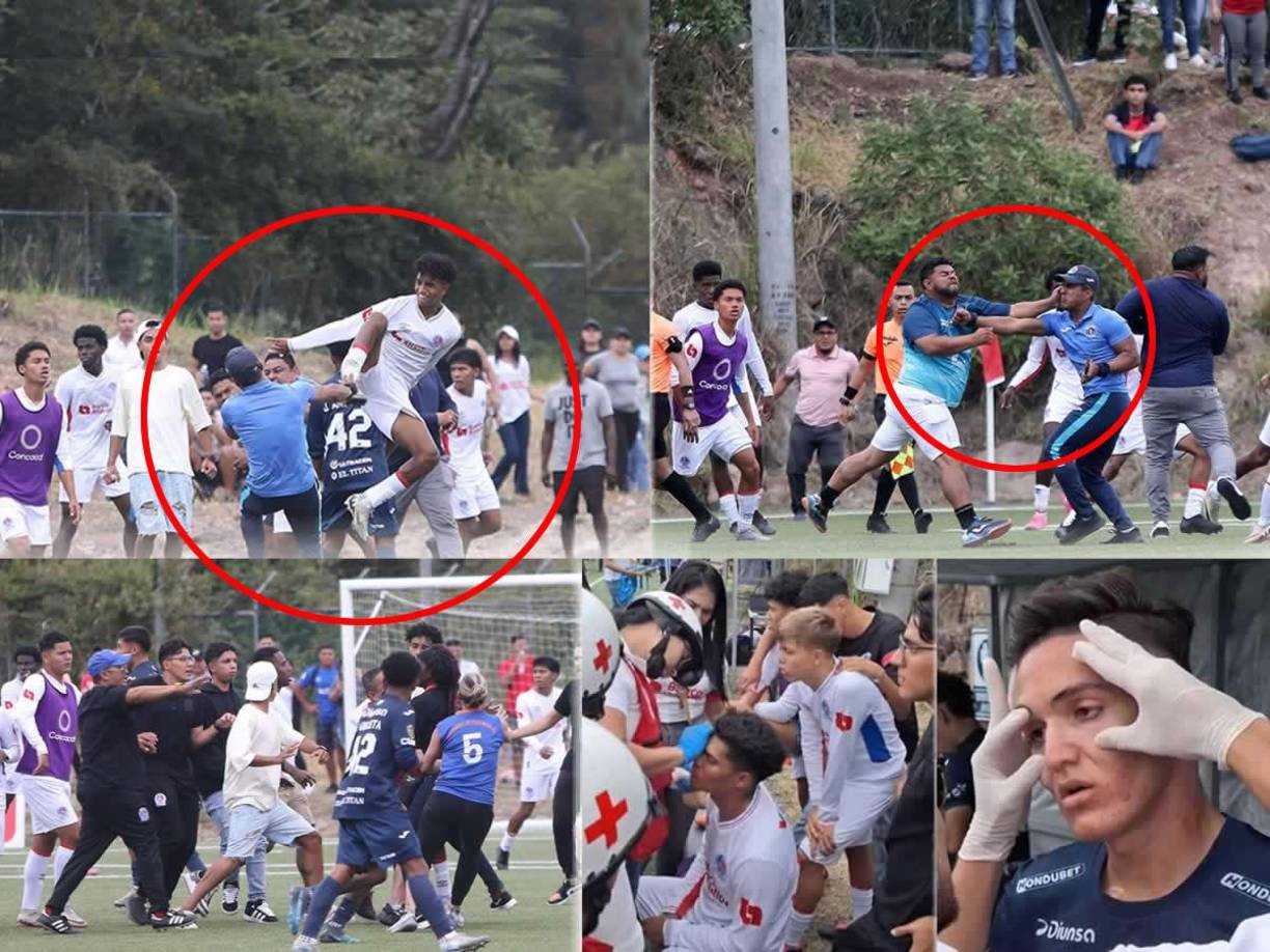 La Gran Final del Torneo de Reservas entre Olimpia y Motagua terminó en tremendo zafarrancho entre futbolistas de ambos equipos y padres de familia que ingresaron al campo.