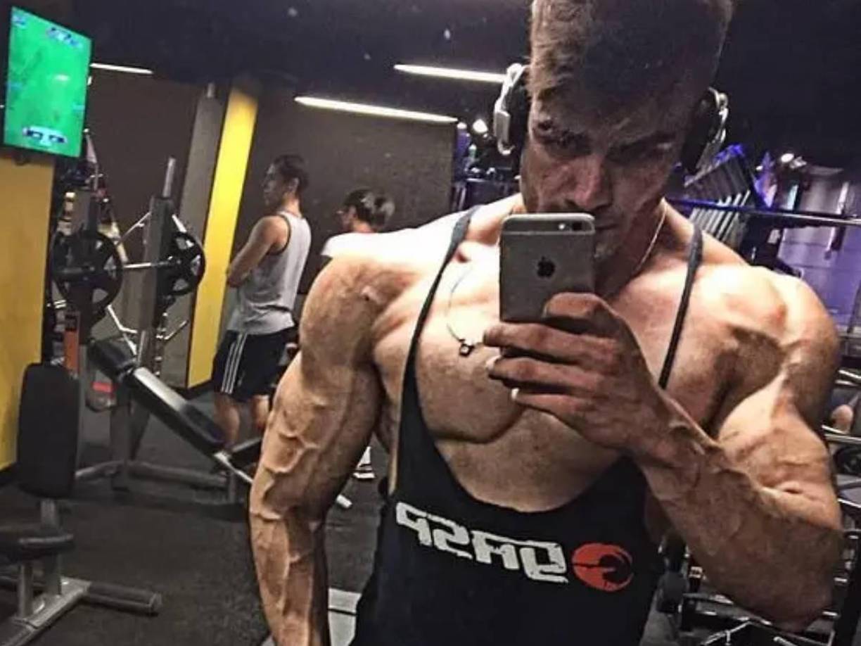 El fisicoculturista logró salir caminando del establecimiento con la ayuda de un amigo y fue llevado de urgencia a una estación de bomberos cercana.