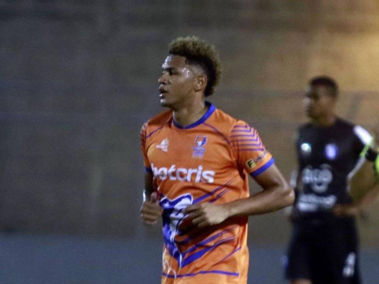 Jack Jean-Baptiste: El centrocampista no seguirá en las filas de la UPNFM y rumores indican que Real España lo tiene en la mira.