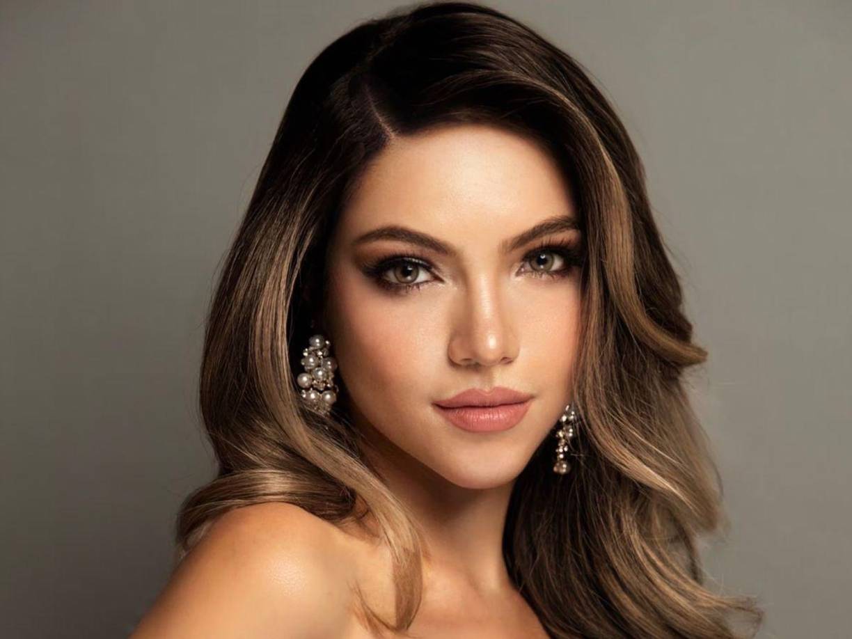 Mara Topic, Miss Ecuador 2024 sufre de una enfermedad que le provoca la caída del cabello. 