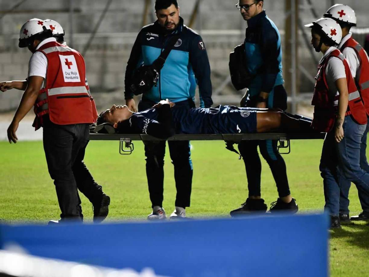 Luis Vega abandonó la cancha en camilla y encendió las alarmas en el Motagua.