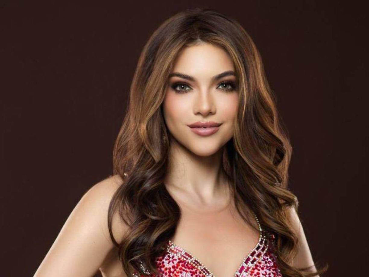 Pero no hay que olvidar que muchas mujeres también las utilizan porque sufren enfermedades, como alopecia, o el tratamiento del cáncer, que puede provocar la caída del cabello. Otra condición menos conocida que también puede provocar esta pérdida de cabello es la enfermedad de Hashimoto, a la que la candidata ecuatoriana a Miss Universo, Mara Topic, está dando visibilidad.