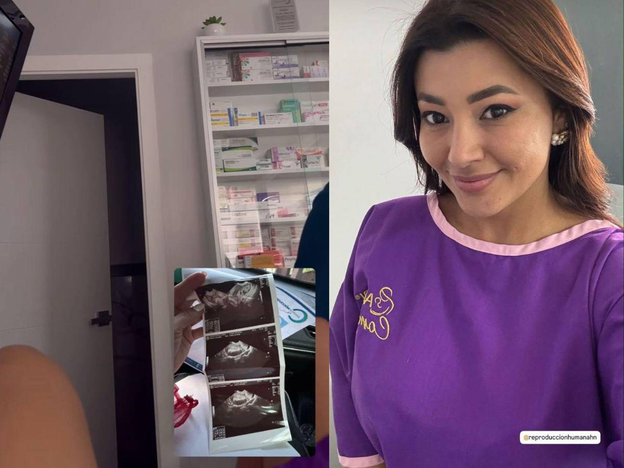 La extrovertida presentadora de televisión hondureña, Milagro Flores, sorprendió recientemente a sus seguidores con la noticia que se convertirá en madre. Aquí más detalles.