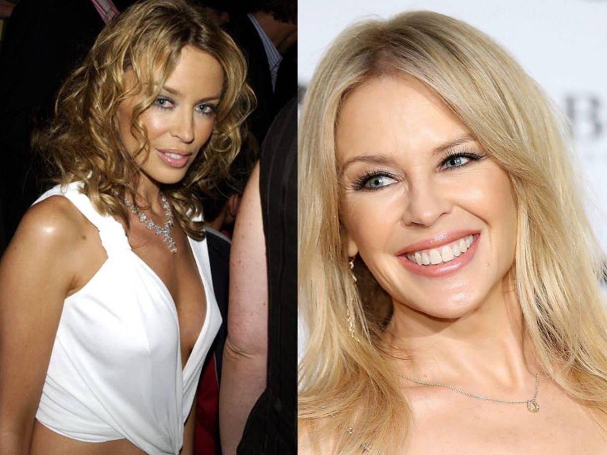 <b>11. Kilye Minogue</b>: su nombre real es Kylie Ann Minogue es una cantante, compositora y actriz australiana. Es ampliamente reconocida por su octavo álbum de estudio Fever y su exitoso sencillo “Can’t Get You Out of My Head”. Desde aquellos años la cantante aún no pierde su espectacular figura y bello rostro.