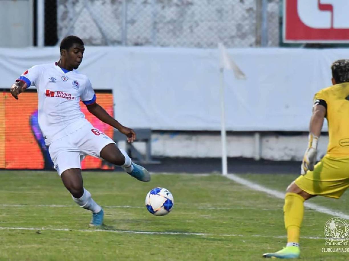 3- Josman Figueroa: El polifuncional por izquierda también se pierde por lesión la final de vuelta. Pedro Troglio informó que el extremo zurdo no está disponible.