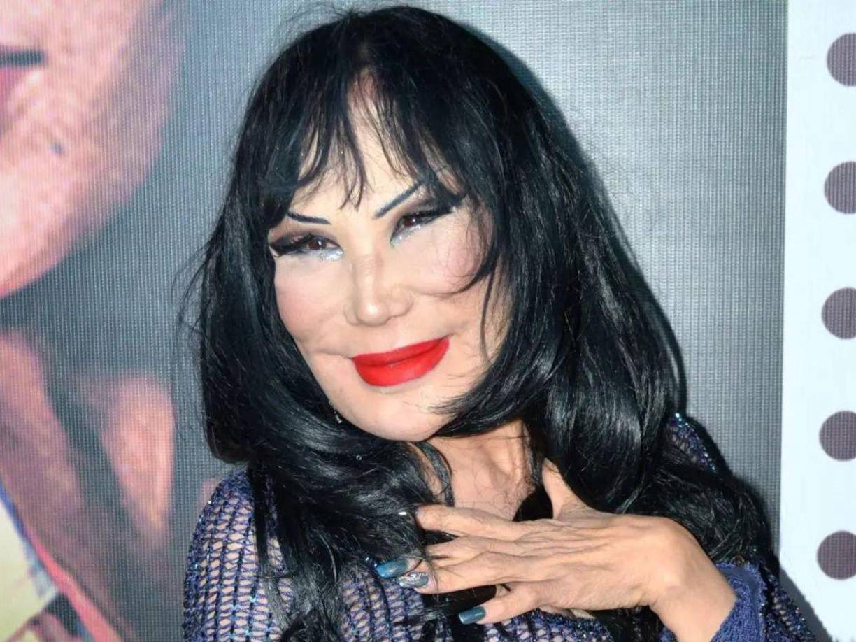 En 2020, ella inició un tratamiento médico y estético para corregir su rostro. Pero una reciente invitación que hizo a sus seguidores para que hagan uso del bótox generó críticas más allá de las redes sociales, pues se sumó a ellas la cubana de 53 años, quien desestimó la campaña de su colega.