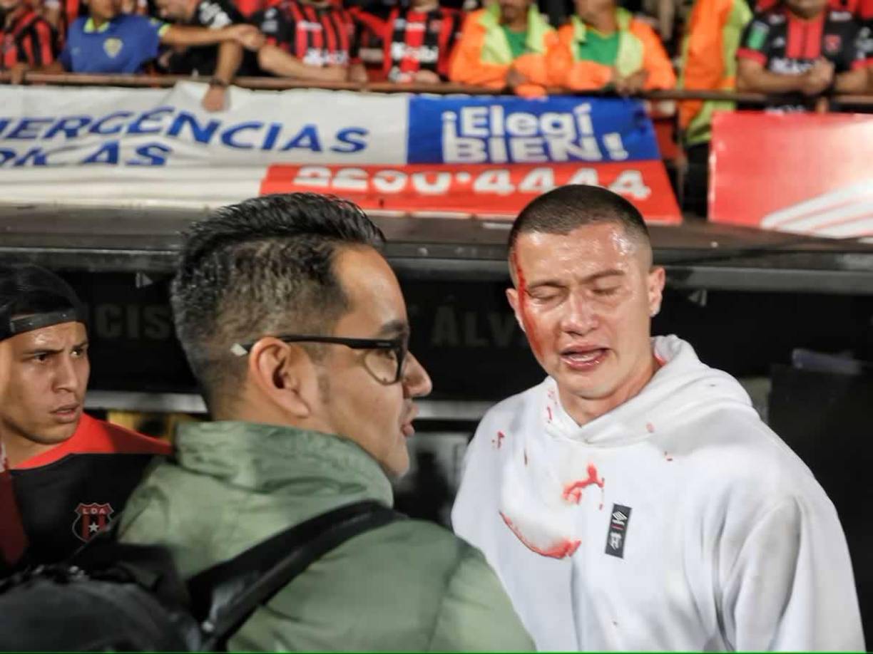 Una de las imágenes más fuertes es la de Johny Álvarez, portero del Alajuelense, quien terminó con una herida en la cabeza y la cara ensangrentada.