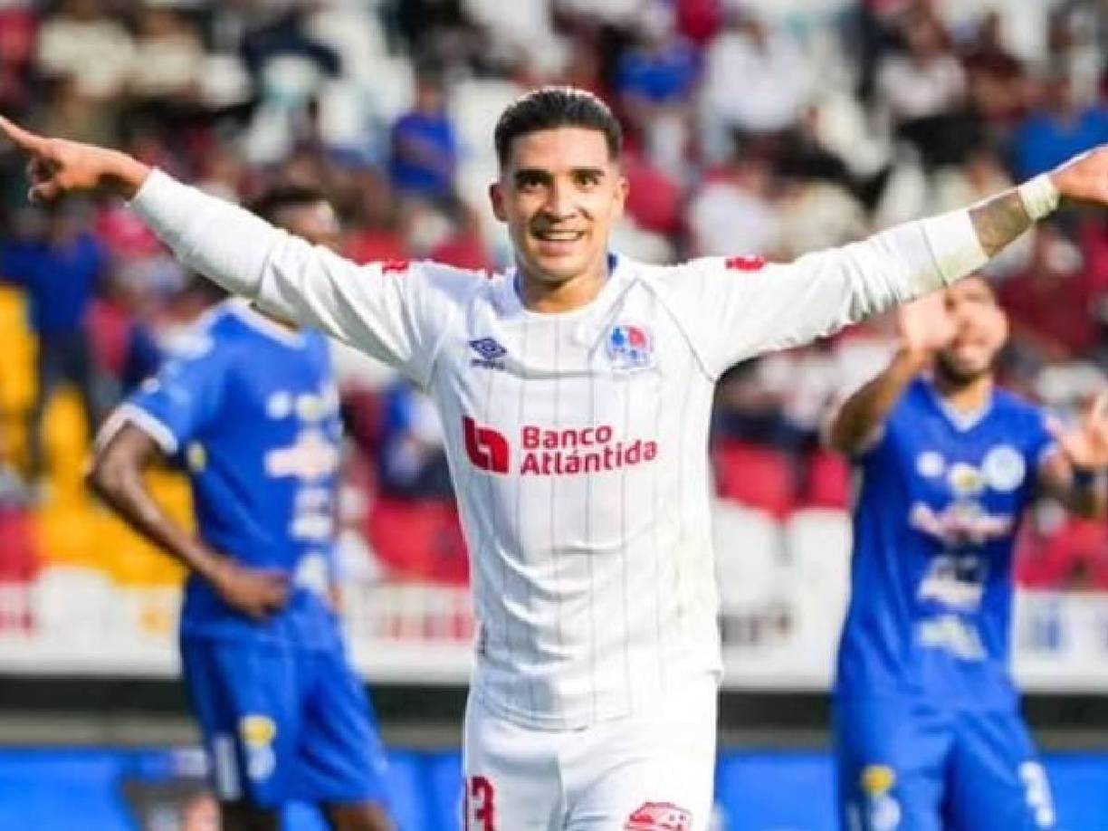 Delanteros: Chirinos será el hombre que ocupe el lugar de Yustin Arboleda, quien fue titular en las semifinales, pero seguramente Pedro Troglio lo cuidará por sus problemas físicos mostrados ante Potros. 
