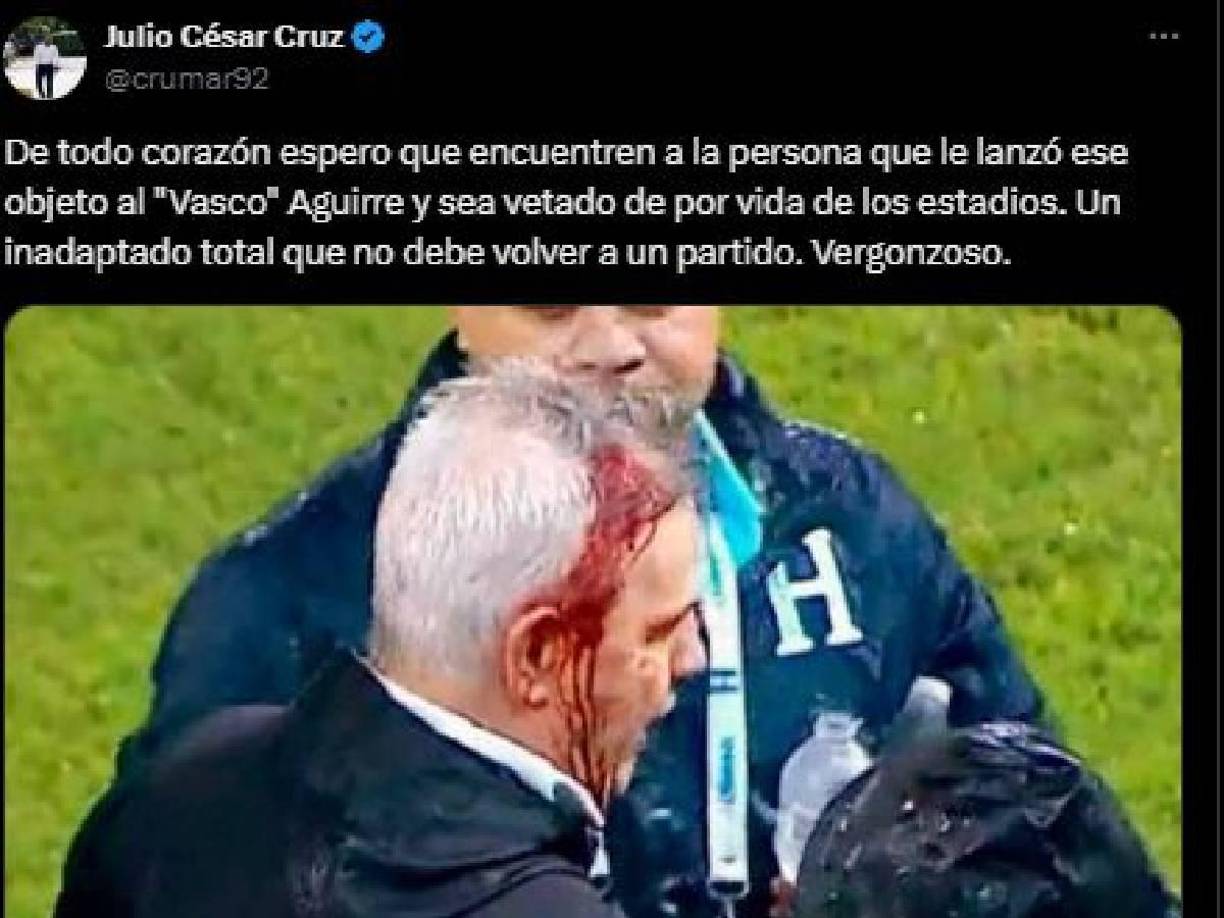 Sobre el incidente con Javier Aguirre comentó: “De todo corazón espero que encuentren a la persona que le lanzó ese objeto al “Vasco” Aguirre y sea vetado de por vida de los estadios. Un inadaptado total que no debe volver a un partido. Vergonzoso”