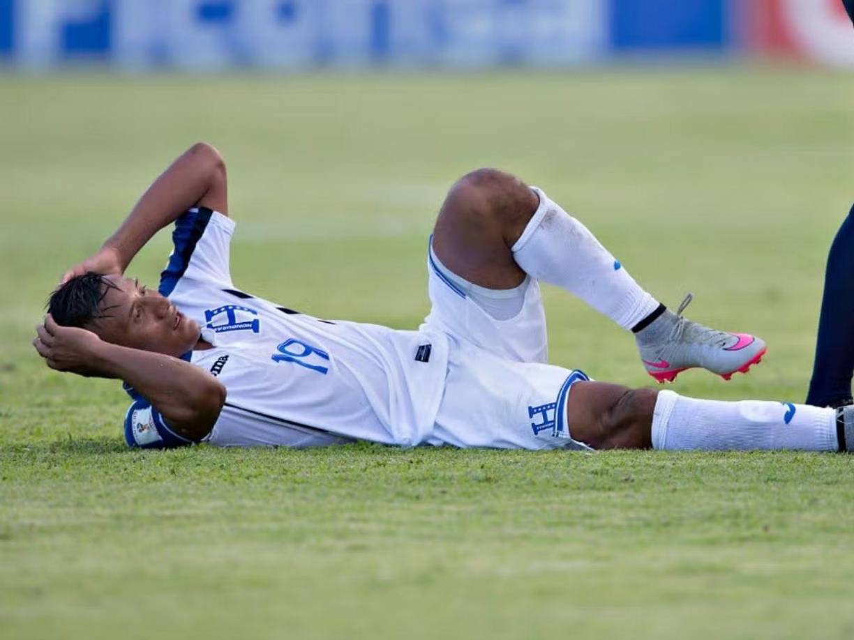 Luis Garrido es muy recordado por esta dura lesión que lo apartó casi un año del fútbol. El volante hondureño vivió momentos de terror en el 2026, año en el que se fracturó la pierna derecha ante México en la Eliminatoria.