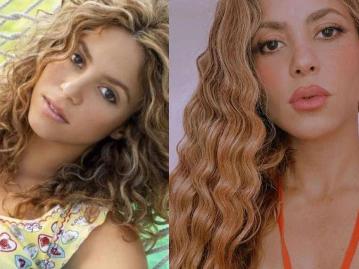 Esta técnica no quirúrgica de belleza es sencilla y tarda menos de una hora en su aplicación, dando resultados inmediatos y reflejándose en el aumento del volumen y perfilación de los labios.