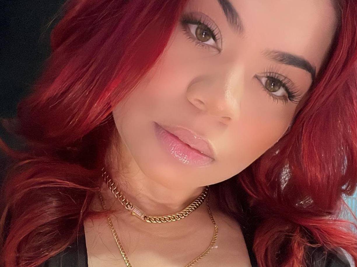 Sin embargo, el cirujano Edgar Contreras la habría convencido de someterse a una abdominoplastia y una liposucción en brazos y piernas, procedimientos adicionales que, según la familia, se realizaron sin su consentimiento previo. 