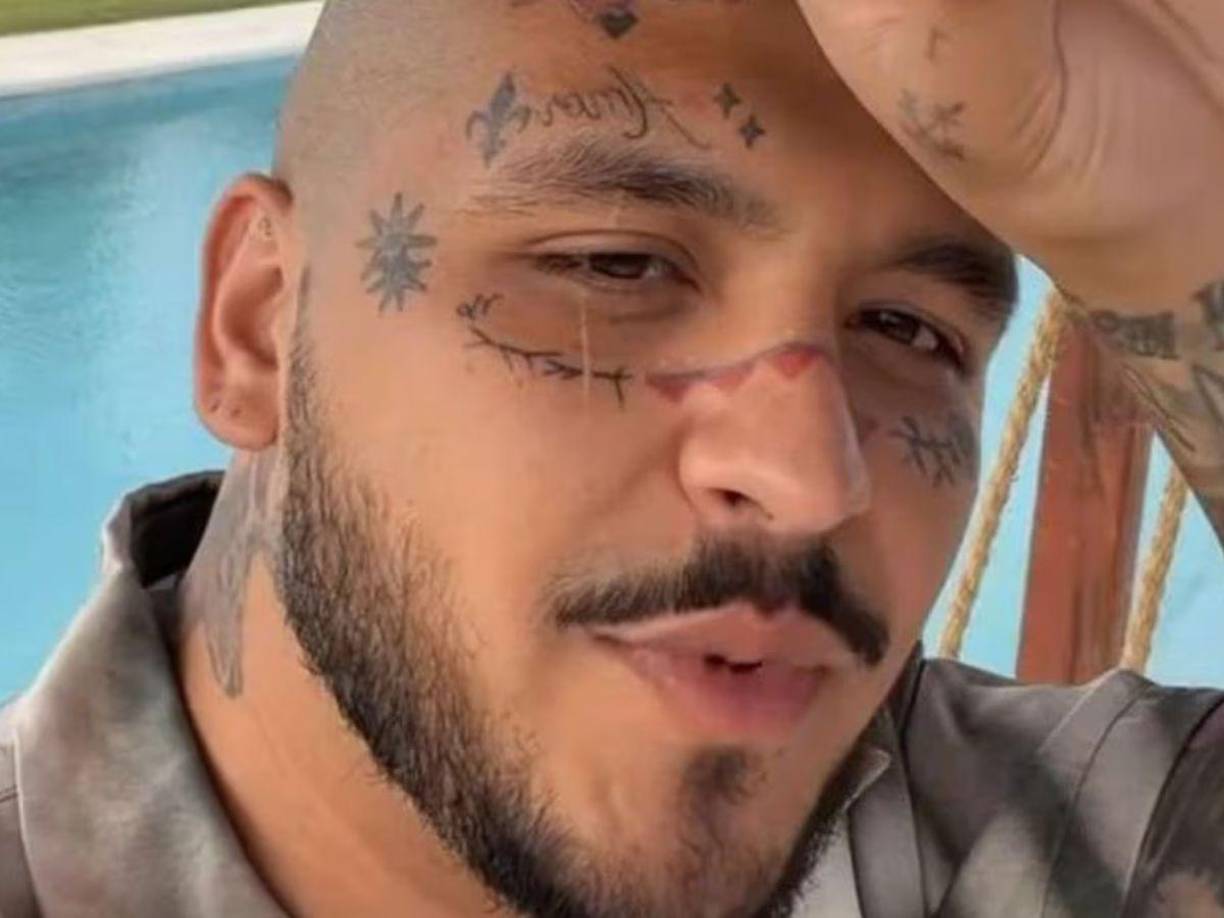 No obstante, muchos de sus fans se han preguntado cuánto dinero está pagando el cantante sonorense por este procedimiento. De acuerdo con “El Gordo y la Flaca”, el precio depende del número de sesiones a las que se someta el cantante.