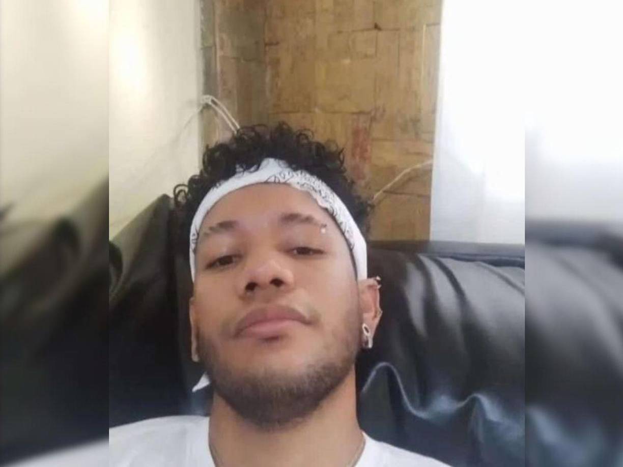 El joven estudiante, de 30 años, sufrió una herida de bala mientras participaba en una manifestación cerca de la Redoma de San Jacinto, en Maracay, estado de Aragua.