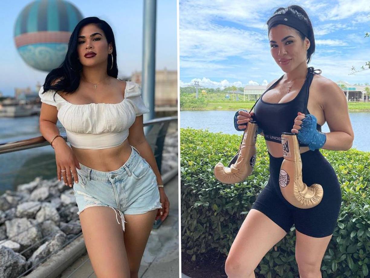 La deportista se tuvo que retirar por las lesiones y ahora incursionara en la famosa plataforma de Only Fans.