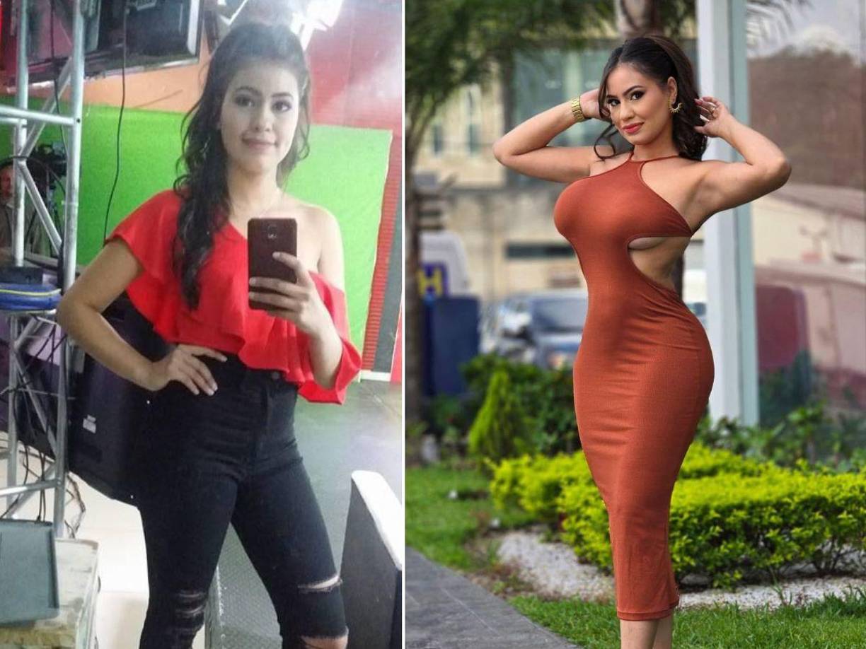 Alejandra Rubio habló por primera vez del motivo que la llevó a operar su cuerpo. 