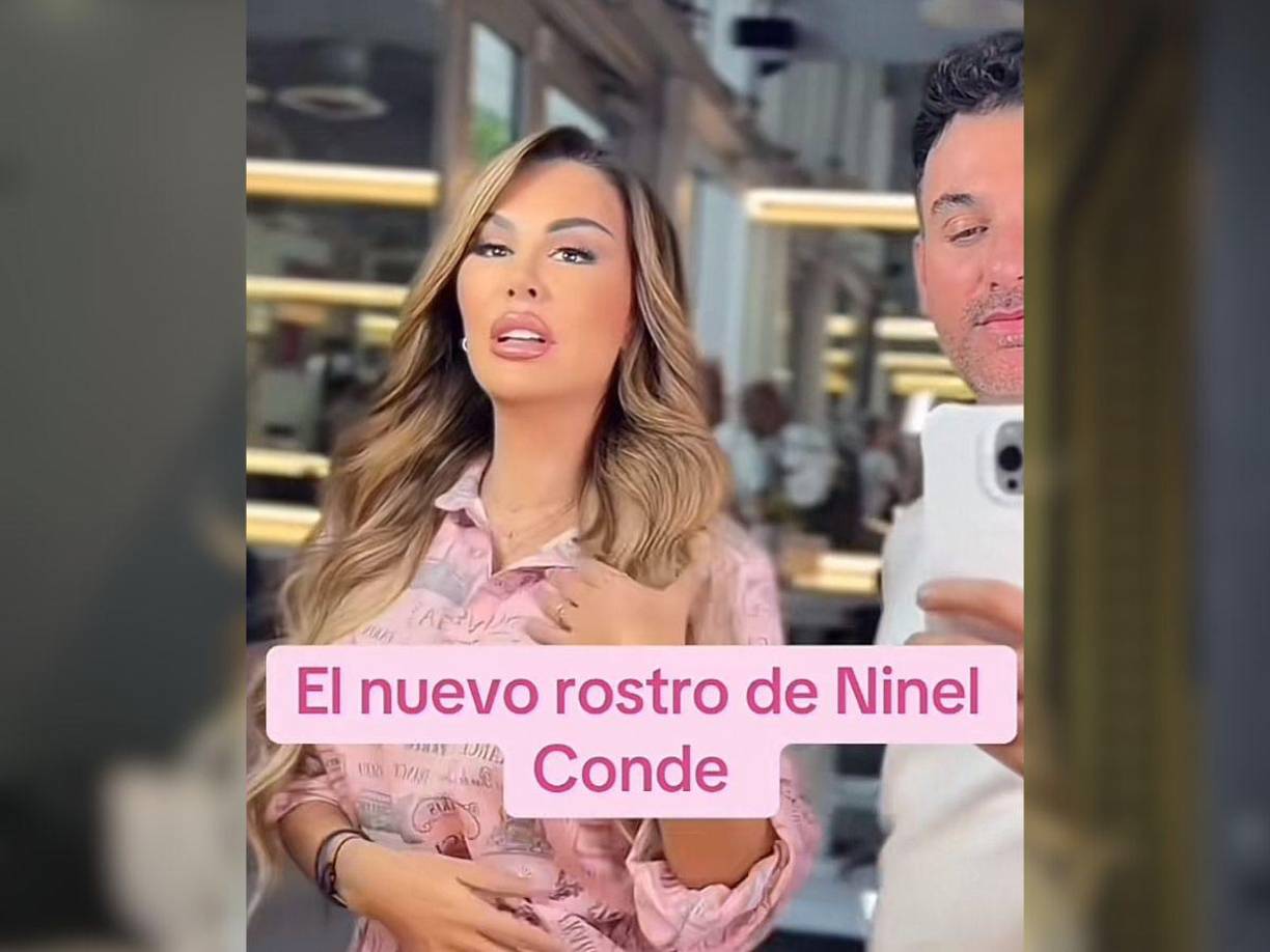 “Están los mejores cirujanos plásticos del mundo. Ella habría viajado hace tres meses y lo que se hizo pues nos da mucha tristeza saber que Ninel es una de las víctimas de los biopolímeros que se fue a retirar a Estambul”, indicó Elisa Beristain, conductora del programa.